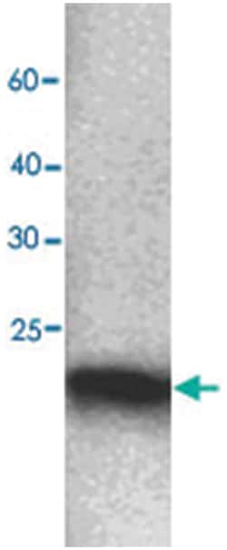 SOD1, Mouse, Clone: 00g5, Abnova 100&mu;L; Unlabeled:Antibodies, Monoclonal