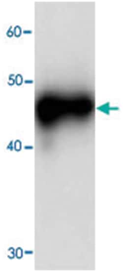 RPSA, Mouse, Clone: 69j0, Abnova 100&mu;L; Unlabeled:Antibodies, Monoclonal