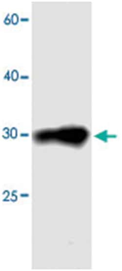 CDCA4, Mouse, Clone: 04sd, Abnova 100&mu;L; Unlabeled:Antibodies, Monoclonal