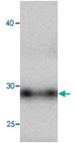 CCL5, Mouse, Clone: 8f64, Abnova 100&mu;L; Unlabeled:Antibodies, Monoclonal