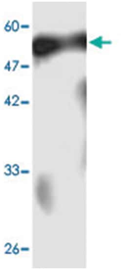 SARS coronavirus N Protein, Mouse, Clone: 38j4, Abnova 100&mu;L; Unlabeled:Antibodies,