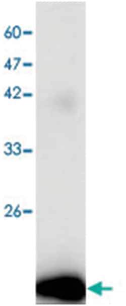 Dengue virus E-D3, Mouse, Clone: 2h65j, Abnova 100&mu;L; Unlabeled:Antibodies,