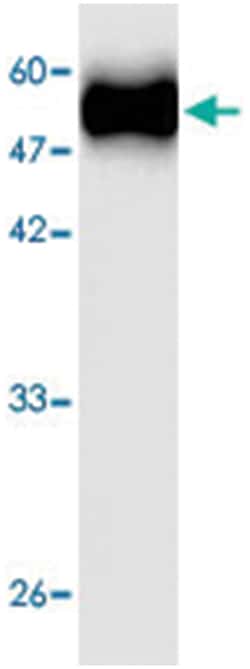 Neisseria meningitidis GNA2132, Mouse, Clone: 87r7, Abnova 100&mu;L; Unlabeled:Antibodies,