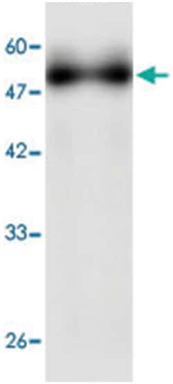 Neisseria meningitidis GNA2132, Mouse, Clone: 88a77, Abnova 100 &mu;L | Buy Online | Abnova Corporation | Fisher Scientific