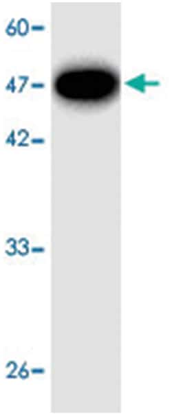 Legionella pneumophila mip, Mouse, Clone: , Abnova 100 &mu;L | Buy Online | Abnova | Fisher Scientific