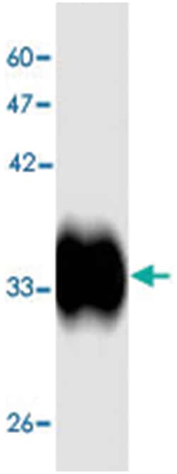 Hepatitis A virus polyprotein, Mouse, Clone: 1s35d, Abnova 100 &mu;L | Buy Online | Abnova Corporation | Fisher Scientific