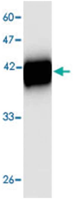 Chro.40414, Mouse, Clone: 21s65, Abnova 100&mu;L; Unlabeled:Antibodies,