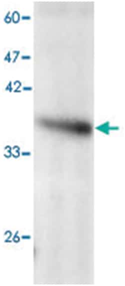 Hepatitis E virus ORF 3, Mouse, Clone: 5576f, Abnova 100&mu;L; Unlabeled:Anticuerpos