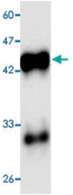 Hepatitis A virus VP1, Mouse, Clone: 5fs8, Abnova 100 &mu;L | Buy Online | Abnova Corporation | Fisher Scientific