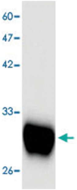 Escherichia coli SLT1, Mouse, Clone: 7e65s, Abnova 100&mu;L; Unlabeled:Antibodies,