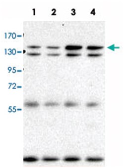 Ahi1, Mouse, Clone: 645s3, Abnova 100&mu;L; Unlabeled:Antibodies, Monoclonal