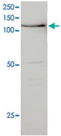 BUB1, Mouse, Clone: P8.14H5.1H1, Abnova 100&mu;g; Unlabeled:Antibodies,