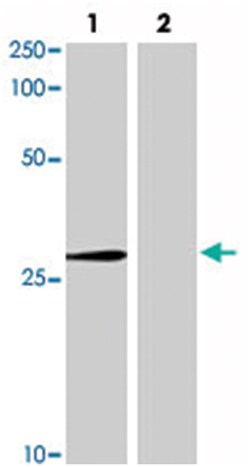 Abcc10, Mouse, Clone: C1.7F12.3G11, Abnova 100&mu;g; Unlabeled:Antibodies,