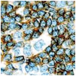CD79B, Mouse, Clone: JS01, Abnova 3 x 1 mL | Buy Online | Abnova Corporation | Fisher Scientific