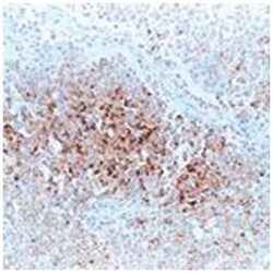 DAXX, Mouse, Clone: 36H11, Abnova 3 x 1 mL | Buy Online | Abnova Corporation | Fisher Scientific