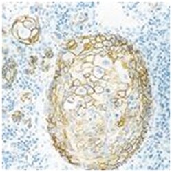 CD44 variant 6, Mouse, Clone: VFF-7, Abnova 3 x 1 mL | Buy Online | Abnova Corporation | Fisher Scientific