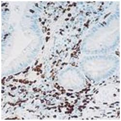 FCGR3A, Mouse, Clone: 2H7, Abnova 3 x 1 mL | Buy Online | Abnova Corporation | Fisher Scientific