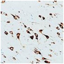 GAP43, Mouse, Clone: 1G7, Abnova 3 x 1 mL | Buy Online | Abnova Corporation | Fisher Scientific