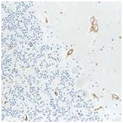 ITGB1, Mouse, Clone: 7F10, Abnova 3 x 1 mL | Buy Online | Abnova Corporation | Fisher Scientific