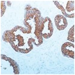 KLK3, Mouse, Clone: 35H9, Abnova 3 x 1 mL | Buy Online | Abnova Corporation | Fisher Scientific