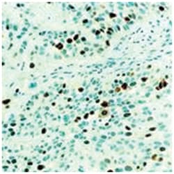 TOP2A, Mouse, Clone: 3F6, Abnova&trade;