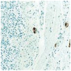 ret Oncoprotein, Mouse, Clone: 3F8, Abnova 3 x 1 mL | Buy Online | Abnova Corporation | Fisher Scientific