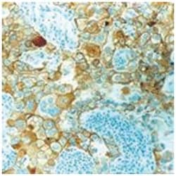 CDH1, Mouse, Clone: 36B5, Abnova 3 x 1mL; Unlabeled:Antibodies, Monoclonal