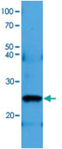 BCL2, Mouse, Clone: AT1B5, Abnova 100&mu;L; Unlabeled:Antibodies, Monoclonal