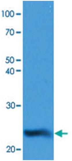 NQO2, Mouse, Clone: AT1E3, Abnova 100&mu;L; Unlabeled:Antibodies, Monoclonal