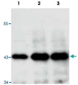 ERK1, Mouse, Clone: E19, Abnova 100 &mu;g | Buy Online | Abnova Corporation | Fisher Scientific