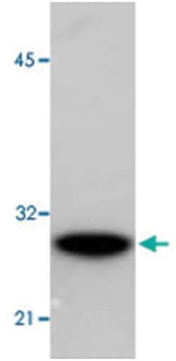 GST, Mouse, Clone: GST.B6/G2R, Abnova 100 &mu;g | Buy Online | Abnova Corporation | Fisher Scientific