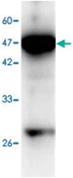 ICAM1, Mouse, Clone: 13, Abnova 100&mu;g; Unlabeled:Antibodies, Monoclonal