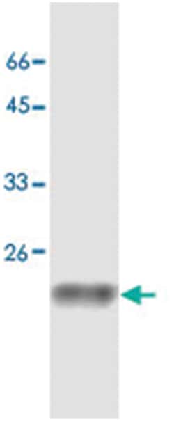 SOD1, Mouse, Clone: 18, Abnova 100&mu;g; Unlabeled:Antibodies, Monoclonal