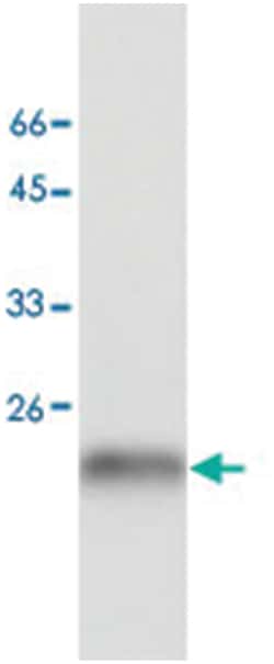 SOD1, Mouse, Clone: 24, Abnova 100&mu;g; Unlabeled:Antibodies, Monoclonal