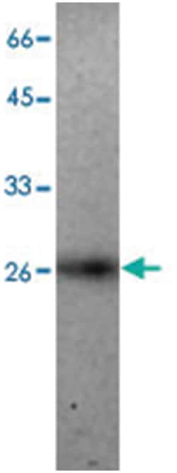 GSTO1, Mouse, Clone: 8, Abnova 100 &mu;g | Buy Online | Abnova Corporation | Fisher Scientific