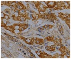 SOD2, Mouse, Clone: 18, Abnova 100&mu;g; Unlabeled:Antibodies, Monoclonal