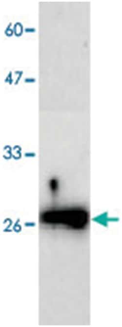 SOD2, Mouse, Clone: 18, Abnova 100&mu;g; Unlabeled:Antibodies, Monoclonal