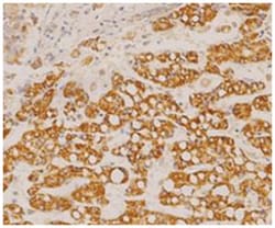 GOT2, Mouse, Clone: 14, Abnova 100&mu;g; Unlabeled:Antibodies, Monoclonal