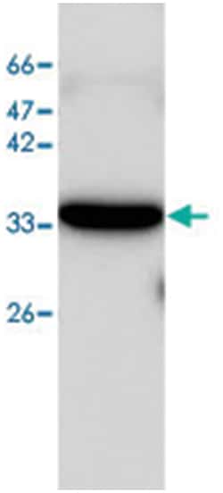 LDHA, Mouse, Clone: 20, Abnova 100&mu;g; Unlabeled:Antibodies, Monoclonal