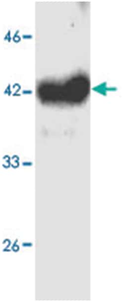 GABPB1, Mouse, Clone: 6, Abnova 100 &mu;g | Buy Online | Abnova | Fisher Scientific