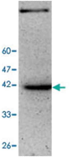ZSCAN22, Mouse, Clone: 19, Abnova 100&mu;g; Unlabeled:Antibodies, Monoclonal
