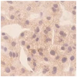 CXCL10, Mouse, Clone: 1, Abnova 100 &mu;g | Buy Online | Abnova | Fisher Scientific