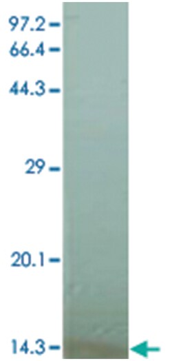 CXCL10, Mouse, Clone: 1, Abnova 100 &mu;g | Buy Online | Abnova | Fisher Scientific