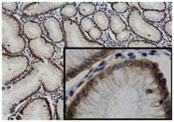 S100A14, Mouse, Clone: 5, Abnova 100&mu;g; Unlabeled:Antibodies, Monoclonal