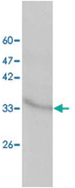 RPSA, Mouse, Clone: 33, Abnova 100&mu;g; Unlabeled:Antibodies, Monoclonal