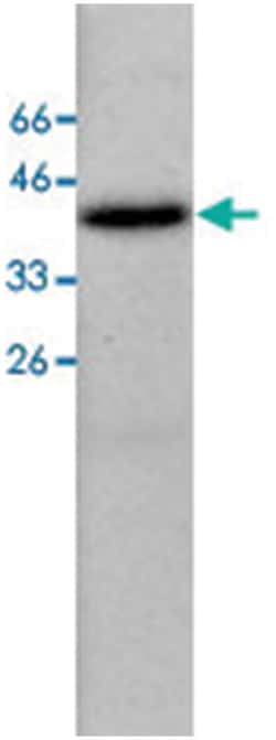 FAH, Mouse, Clone: 26, Abnova 100&mu;g; Unlabeled:Antibodies, Monoclonal
