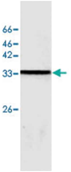 SAA1, Mouse, Clone: 11, Abnova 100&mu;g; Unlabeled:Antibodies, Monoclonal