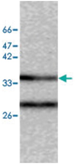 CAPZA2, Mouse, Clone: 40, Abnova 100&mu;g; Unlabeled:Antibodies, Monoclonal