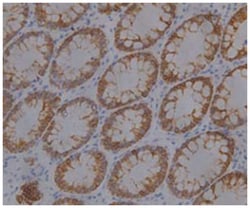 KRT19, Mouse, Clone: 7, Abnova 100&mu;g; Unlabeled:Antibodies, Monoclonal
