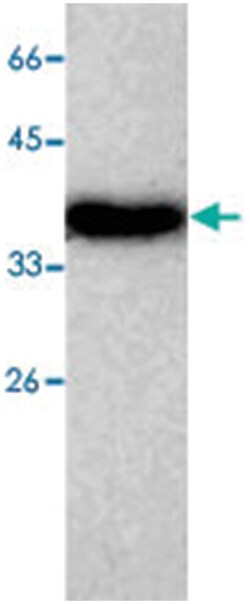 ADK, Mouse, Clone: 7, Abnova 100&mu;g; Unlabeled:Antibodies, Monoclonal